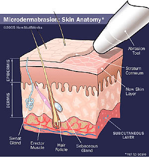 Microdermabrasion: skin anatomy