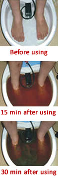 Ionic Foot Detox