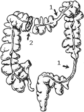 Colon