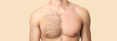 Hair Remove