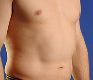 Ultrasound Treatment Spa New York